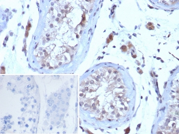 IHC staining of FFPE human testis tissue with Choriogonadotropin Receptor antibody (clone LHCGR/7398). Inset: PBS used in place of primary Ab (secondary Ab negative control). HIER: boil tissue sections in pH 9 10mM Tris with 1mM EDTA for 20 min and allow to cool before testing.~