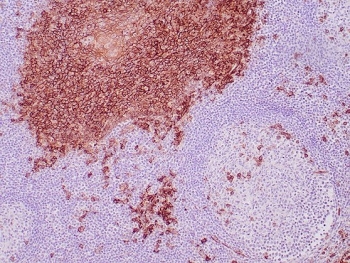 IHC staining of FFPE human tonsil tissue with CD138 antibody (clone SDC1/7177). HIER: boil tissue sections in pH 9 10mM Tris with 1mM EDTA for 20 min and allow to cool before testing.~