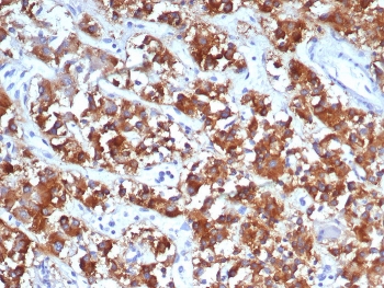 IHC staining of FFPE human adrenal gland tissue with IL18R1 antibody (clone IL18R1/7591). HIER: boil tissue sections in pH 9 10mM Tris with 1mM EDTA for 20 min and allow to cool before testing.~