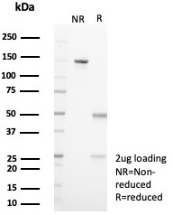 SDS-PAGE analysis of purified, BSA-free IL18