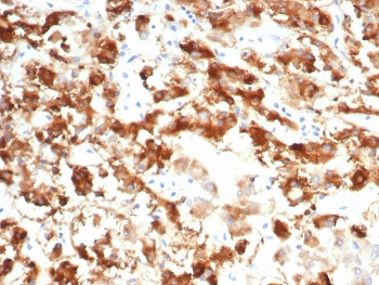 IHC staining of FFPE human adrenal gland tissue with Interleukin 18 receptor alpha antibody (clone IL18R1/7592). HIER: boil tissue sections in pH 9 10mM Tris with 1mM EDTA for 20 min and allow to cool before testing.~
