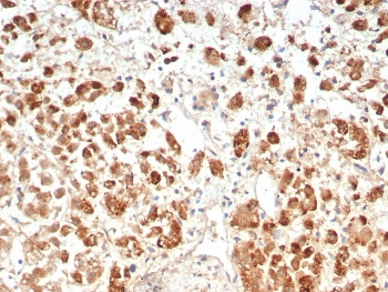 IHC staining of FFPE human adrenal gland tissue with IL-18R alpha antibody (clone IL18R1/7593). HIER: boil tissue sections in pH 9 10mM Tris with 1mM EDTA for 20 min and allow to cool before testing.~