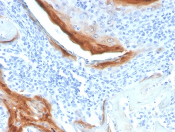 IHC staining of FFPE human tonsil tissue with IL-1RA antibody (clone IL1RA/4712). HIER: boil tissue sections in pH 9 10mM Tris with 1mM EDTA for 20 min and allow to cool before testing.~