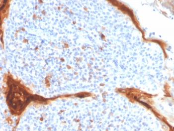 IHC staining of FFPE human tonsil tissue with Interleukin-1 Receptor Antagonist antibody (clone IL1RA/4715). HIER: boil tissue sections in pH 9 10mM Tris with 1mM EDTA for 20 min and allow to cool before testing.~