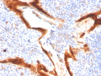 IHC staining of FFPE human tonsil tissue with IL1RN antibody (clone IL1RA/4716). HIER: boil tissue sections in pH 9 10mM Tris with 1mM EDTA for 20 min and allow to cool before testing.~