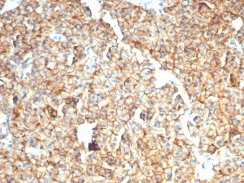 IHC staining of FFPE dog liver with EpCAM / CD326 antibody (clone rEGP40/7334). HIER: boil tissue sections in pH 9 10mM Tris with 1mM EDTA for 20 min and allow to cool before testing.~