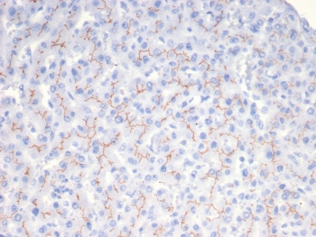 IHC staining of FFPE human liver tissue with BSEP antibody (clone BSEP/7534). HIER: boil tissue sections in pH 9 10mM Tris with 1mM EDTA for 20 min and allow to cool before testing.~