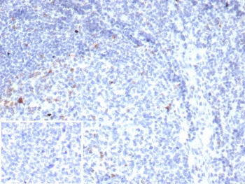 IHC staining of FFPE human tonsil tissue with CTLA4 antibody (clone rCTLA4/7219). Inset: PBS used in place of primary Ab (secondary Ab negative control). HIER: boil tissue sections in pH 9 10mM Tris with 1mM EDTA for 20 min and allow to cool before testing.