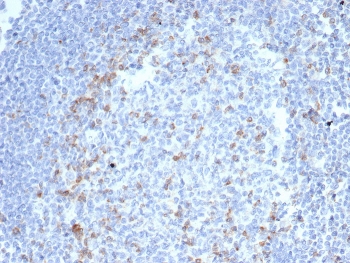 IHC staining of FFPE human tonsil tissue with Cytotoxic T-lymphocyte protein 4 antibody (clone CTLA4/6867R). HIER: boil tissue sections in pH 9 10mM Tris with 1mM EDTA for 20 min and allow to cool before testing.~