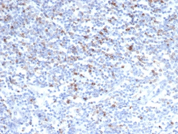 IHC staining of FFPE human tonsil tissue with CD152 antibody (clone CTLA4/6868R). HIER: boil tissue sections in pH 9 10mM Tris with 1mM EDTA for 20 min and allow to cool before testing.~