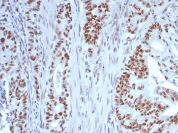 IHC staining of FFPE human colon tissue with Nucleolin antibody (clone NCL/7339). HIER: boil tissue sections in pH 9 10mM Tris with 1mM EDTA for 20 min and allow to cool before testing.~