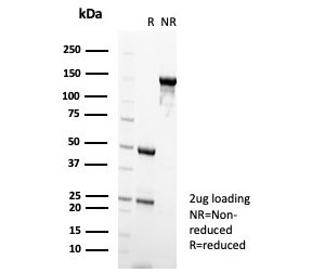 SDS-PAGE analysis of purified, BSA-free Nucleolin an