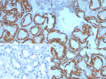 IHC staining of FFPE human kidney tissue with HSP60 antibody (clone HSPD1/8398R). Inset: PBS used in place of primary Ab (secondary Ab negative control). HIER: boil tissue sections in pH 9 10mM Tris with 1mM EDTA for 20 min and allow to cool before testing.~