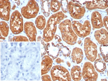 IHC staining of FFPE human kidney tissue with HSP60 antibody (clone HSPD1/8406R). Inset: PBS used in place of primary Ab (secondary Ab negative control). HIER: boil tissue sections in pH 9 10mM Tris with 1mM EDTA for 20 min and allow to cool before testing.~