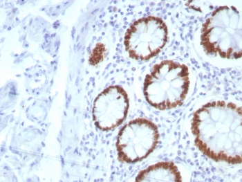 IHC staining of FFPE human colon tissue with SATB2 antibody (clone SATB2/8877R). HIER: boil tissue sections in pH 9 10mM Tris with 1mM EDTA for 20 min and allow to cool before testing.~