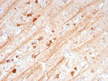 IHC staining of FFPE human brain tissue with MAP2 antibody (clone MAP2/7673). HIER: boil tissue sections in pH 9 10mM Tris with 1mM EDTA for 20 min and allow to cool before testing.~