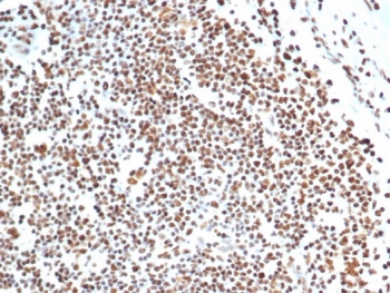 IHC staining of FFPE human lymph node tissue with XRCC5 / Ku86 / Ku80 antibody (clone XRCC5/7316). HIER: boil tissue sections in pH 9 10mM Tris with 1mM EDTA for 20 min and allow to cool before testing.