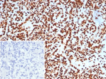 IHC staining of FFPE human lymph node tissue with XRCC5 / Ku86 / Ku80 antibody (clone XRCC5/7313). Inset: PBS used in place of primary Ab (secondary Ab negative control). HIER: boil tissue sections in pH 9 10mM Tris with 1mM EDTA for 20 min and allow to cool before testing.~