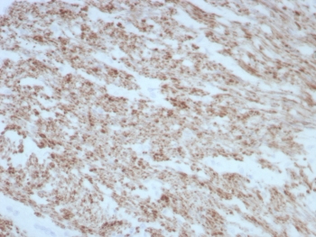 IHC staining of FFPE human smooth muscle tissue with DES antibody (clone rDES/8846). HIER: boil tissue sections in pH 9 10mM Tris with 1mM EDTA for 20 min and allow to cool before testing.~