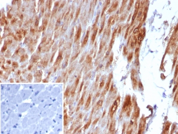 IHC staining of FFPE human heart muscle tissue with Desmin antibody (clone DES/8610R). Inset: PBS used in place of primary Ab (secondary Ab negative control). HIER: boil tissue sections in pH 9 10mM Tris with 1mM EDTA for 20 min and allow to cool before testing.~