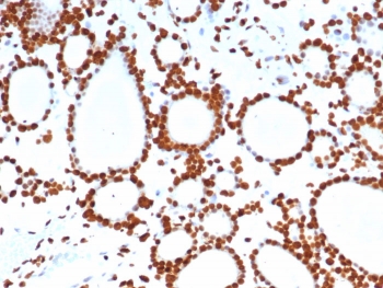 IHC staining of FFPE human thyroid tissue with PET-1 antibody (clone FEV/7311). HIER: boil tissue sections in pH 9 10mM Tris with 1mM EDTA for 20 min and allow to cool before testing.~