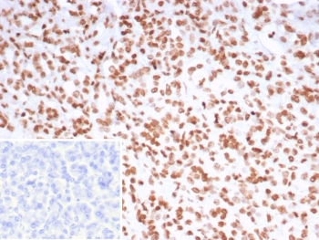 IHC staining of FFPE human pancreas tissue with PET-1