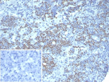IHC staining of FFPE human lymph node tissue with PAX3 antibody (clone PAX3/8426). Inset: PBS used in place of primary Ab (secondary Ab negative control). HIER: boil tissue sections in pH 9 10mM Tris with 1mM EDTA for 20 min and allow to cool before testing.~