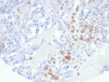 IHC staining of FFPE human lung tissue with IRS1 antibody (clone IRS1/7571). HIER: boil tissue sections in pH 9 10mM Tris with 1mM EDTA for 20 min and allow to cool before testing.~