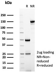 SDS-PAGE analysis of purified, BSA-free IRS1 antibody (cl