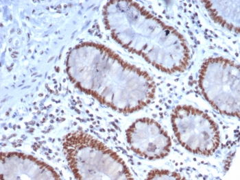IHC staining of FFPE human colon tissue with Nucleolin antibody (clone NCL/7337). HIER: boil tissue sections in pH 9 10mM Tris with 1mM EDTA for 20 min and allow to cool before testing.~