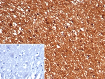 IHC staining of FFPE human brain tissue with GBX2 antibody (clone GBX2/7235). Inset: PBS used in place of primary Ab (secondary Ab negative control). HIER: boil tissue sections in pH 9 10mM Tris with 1mM EDTA for 20 min and allow to cool before testing.~