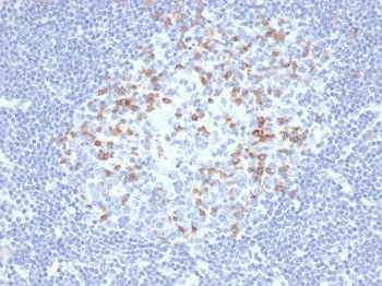 IHC staining of FFPE human lymph node tissue with PD1 (CD279) antibody (clone PDCD1/4231R). HIER: boil tissue sections in pH 9 10mM Tris with 1mM EDTA for 20 min and allow to cool before testing.~