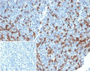 IHC staining of FFPE human tonsil tissue w
