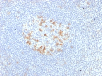 IHC staining of FFPE human tonsil tissue with PD1 (CD279) antibody (clone PDCD1/7276R). HIER: boil tissue sections in pH 9 10mM Tris with 1mM EDTA for 20 min and allow to cool before testing.~