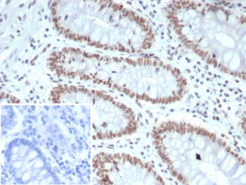 IHC staining of FFPE human colon tissue with MutL Homolog 1 antibody (clone MLH1/7562). HIER: boil tissue sections in pH 9 10mM Tris with 1mM EDTA for 20 min and allow to cool before testing.~