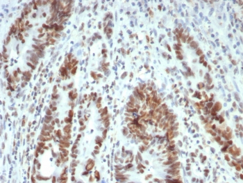 IHC staining of FFPE human colon tissue with MutL Homolog 1 antibody (clone MLH1/7563). HIER: boil tissue sections in pH 9 10mM Tris with 1mM EDTA for 20 min and allow to cool before testing.~