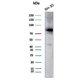 Western blot testing of human RH30 cell lysate with Catenin Beta antibody (clone CTNNB1/7760). Expected molecular weight: 85-95 kDa.~