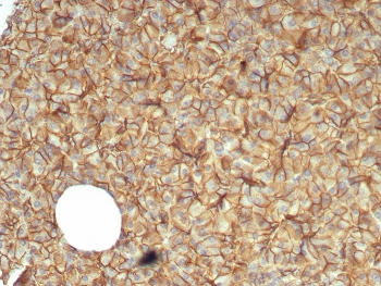 IHC staining of FFPE human pancreas tissue with Catenin Beta antibody (clone CTNNB1/7760). HIER: boil tis