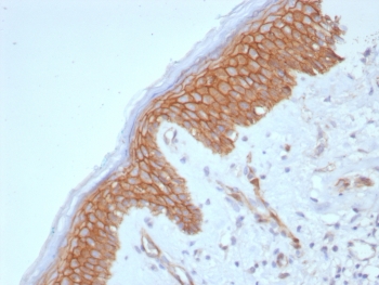 IHC staining of FFPE human skin tissue with Beta-Catenin antibody (clone CTNNB1/8280R). HIER: boil tissue sections in pH 9 10mM Tris with 1mM EDTA for 20 min and allow to cool before testing.~