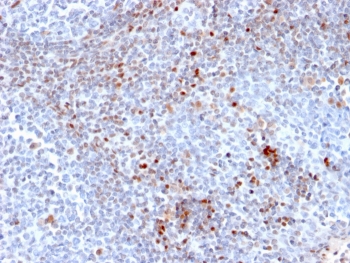 IHC staining of FFPE human tonsil tissue with SATB1 antibody (clone SATB1/2661). HIER: boil tissue sections in pH 9 10mM Tris with 1mM EDTA for 20 min and allow to cool before testing.~