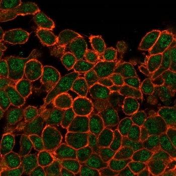 Immunofluorescent staining of PFA-fixed human HeLa cells with SATB1 antibody (green, clone PCRP-SATB1-2C3) and phalloidin (red).~