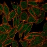 Immunofluorescent staining of PFA-fixed human HeLa cells with ZXDC antibody (clone PCRP-ZXDC-2B5). followed by goat anti-mouse IgG-CF488 (green); Red = CF640R phalloidin.