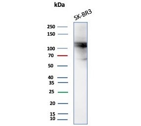 Western blot testing of human SK-BR-3 cell lysate with ADH1L1 antibody (clone ALDH1L1/7701). Predicted molecular weight ~98 kDa.~