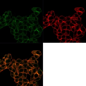 Immunofluorescent staining of PFA-fixed human MCF-7 cells with Lactotransferrin antibody (Green, clone LTF/4074); Red = Phalloidin; Yellow-Brown = superimposed.~