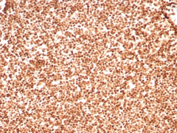 IHC staining of FFPE human lymph node tissue with Histone H1 antibody (clone rHH1/8702). HIER: boil tissue sections in pH 9 10mM Tris with 1mM EDTA for 20 min and allow to cool before testing.~