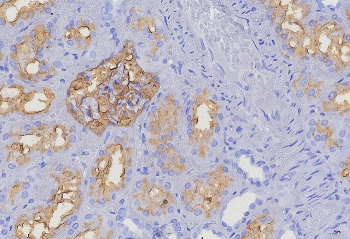 IHC staining of FFPE human kidney tissue with CD10 antibody (clone MME/8376R). HIER: boil tissue sections in pH 9 10mM Tris with 1mM EDTA for 20 min and allow to cool before testing.~