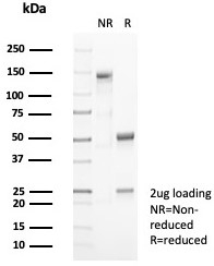 SDS-PAGE analysis of purified, BSA-free CD10 antibody (