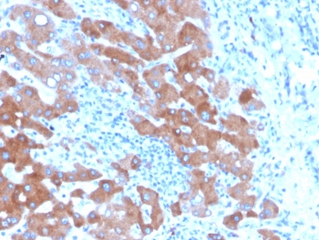 IHC staining of FFPE human liver tissue with Transferrin antibody (clone TF/4796). HIER: boil tissue sections in pH 9 10mM Tris with 1mM EDTA for 20 min and allow to cool before testing.~
