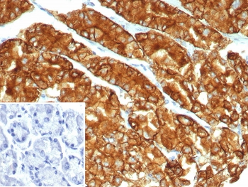 IHC staining of FFPE human stomach tissue with Claudin18.2 antibody (clone CLDN18.2/7300R). Inset: PBS used in place of primary Ab (secondary Ab negative control). HIER: boil tissue sections in pH 9 10mM Tris with 1mM EDTA for 20 min and allow to cool before testing.