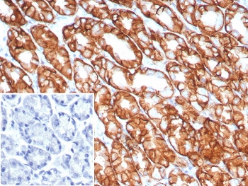 IHC staining of FFPE human stomach tissue with Claudin18.2 antibody (clone CLDN18.2/8141R). Inset: PBS used in place of primary Ab (secondary Ab negative control). HIER: boil tissue sections in pH 9 10mM Tris with 1mM EDTA for 20 min and allow to cool before testing.